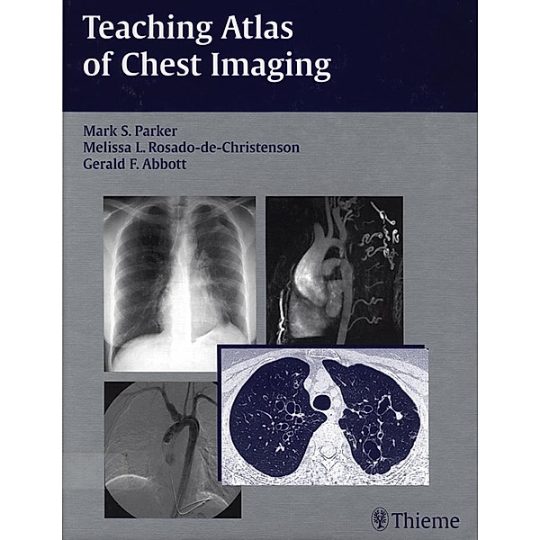 Teaching Atlas of Chest Imaging, Mark S. Parker, Melissa L. Rosado-de-Christenson, Gerald F. Abbott