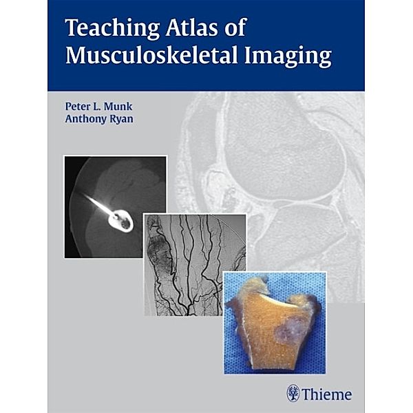 Teaching Atlas of Musculoskeletal Imaging, Peter L. Munk, Anthony G. Ryan