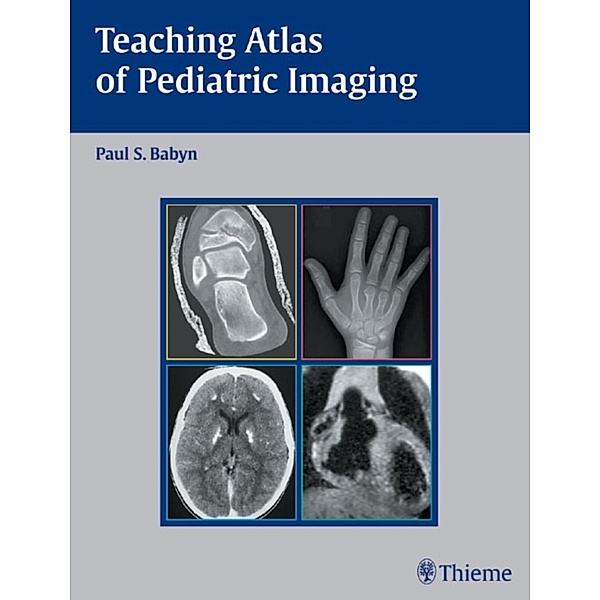 Teaching Atlas of Pediatric Imaging, Paul S. Babyn