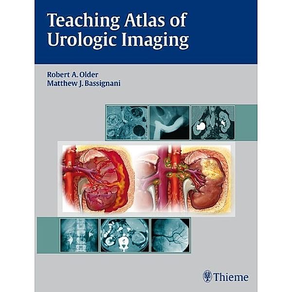 Teaching Atlas of Urologic Imaging, Robert A. Older, Matthew Bassignani