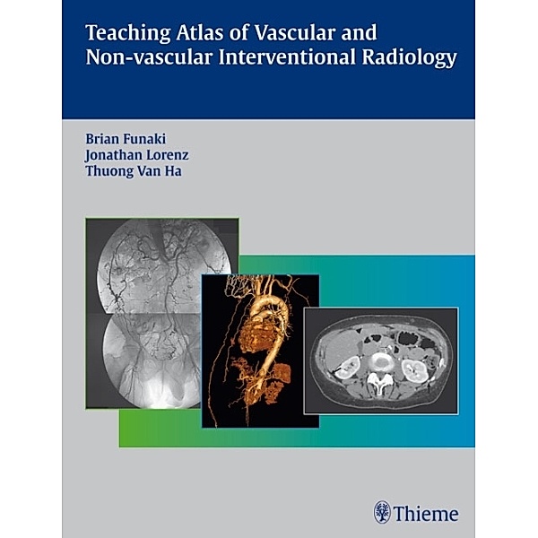Teaching Atlas of Vascular and Non-Vascular Interventional Radiology, Brian Funaki, Jonathan M. Lorenz, Thuong Van Ha