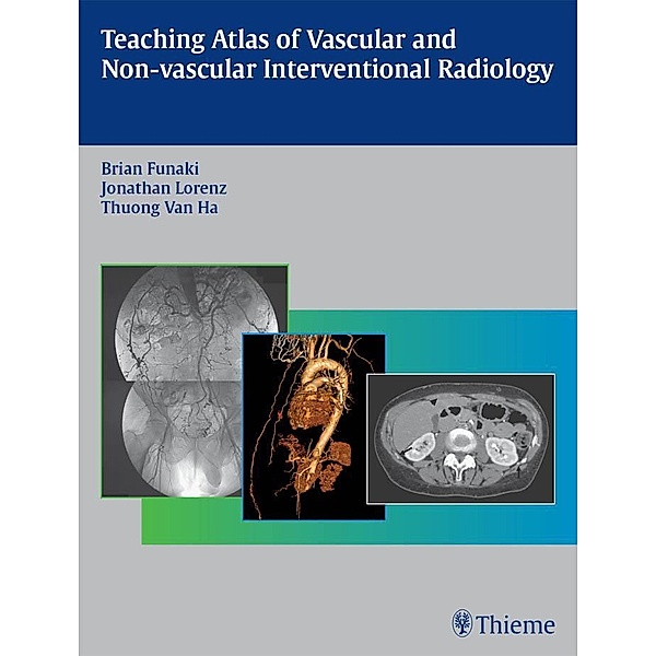 Teaching Atlas of Vascular and Non-vascular Interventional Radiology, Brian Funaki, Jonathan Lorenz, Thuong Van Ha