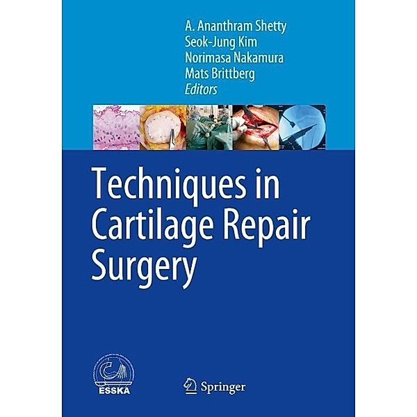 Techniques in Cartilage Repair Surgery