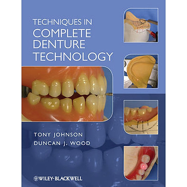 Techniques in Complete Denture Technology, Duncan J. Wood