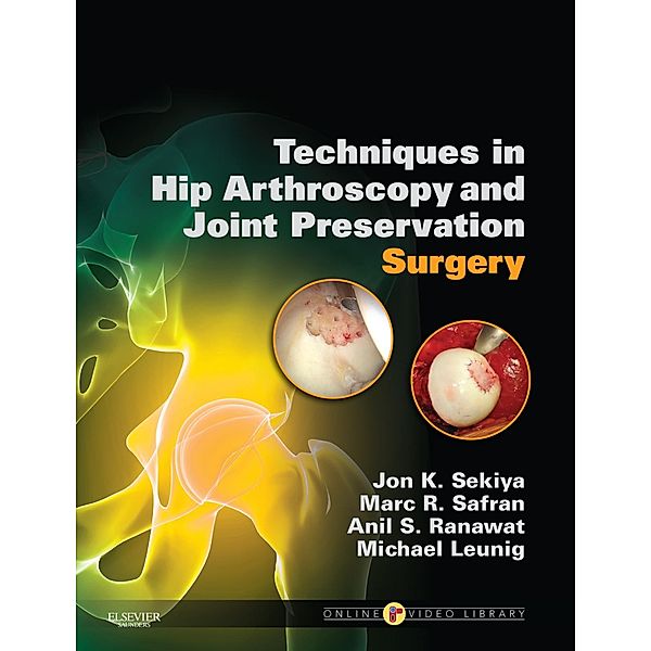 Techniques in Hip Arthroscopy and Joint Preservation E-Book, Jon K. Sekiya, Marc Safran, Anil S. Ranawat, Michael Leunig