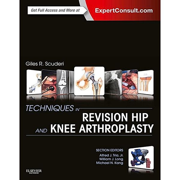 Techniques in Revision Hip and Knee Arthroplasty E-Book, Giles R Scuderi