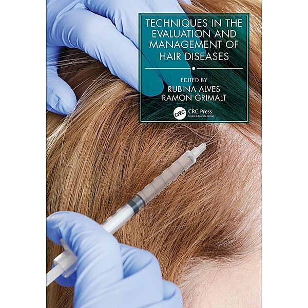 Techniques in the Evaluation and Management of Hair Diseases