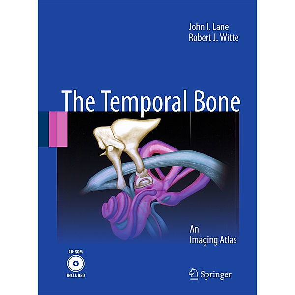 Temporal Bone, John I. Lane, Robert J. Witte