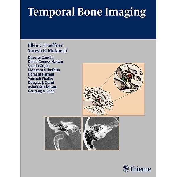Temporal Bone Imaging, Ellen G. Hoeffner, Suresh K. Mukherji