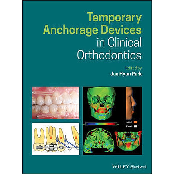 Temporary Anchorage Devices in Clinical Orthodontics, Jae Hyun Park