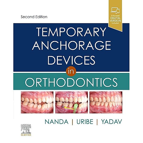 Temporary Anchorage Devices in Orthodontics, Ravindra Nanda, Flavio Andres Uribe, Sumit Yadav