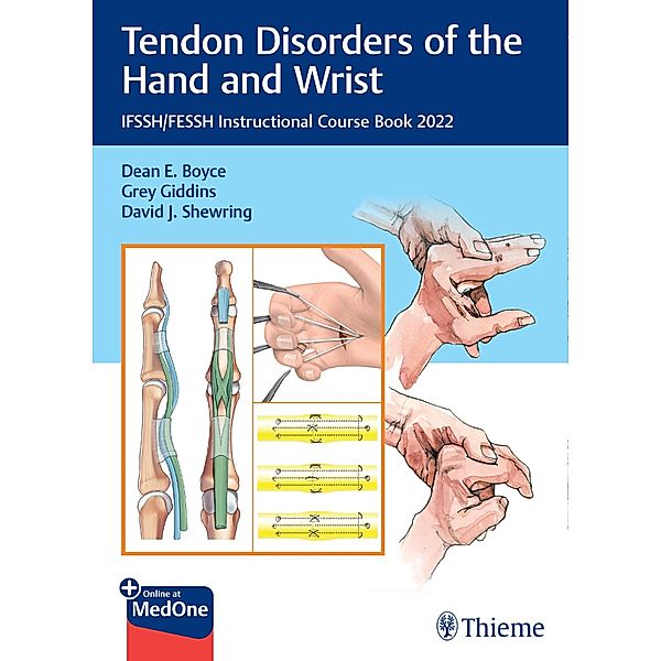 Tendon Disorders of the Hand and Wrist