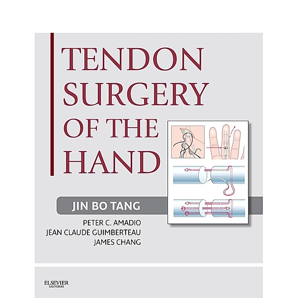 Tendon Surgery of the Hand E-Book, Jin Bo Tang, Peter C. Amadio, Jean Claude Guimberteau, James Chang