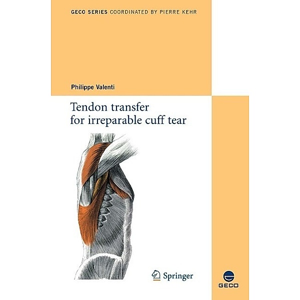 Tendon transfer for irreparable cuff tear / Collection GECO
