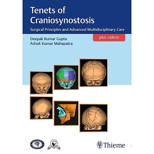 Tenets of Craniosynostosis