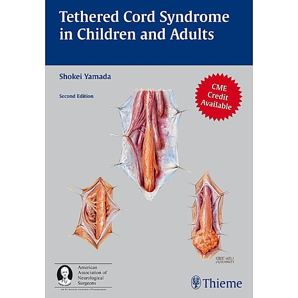 Tethered Cord Syndrome in Children and Adults, Shokei Yamada