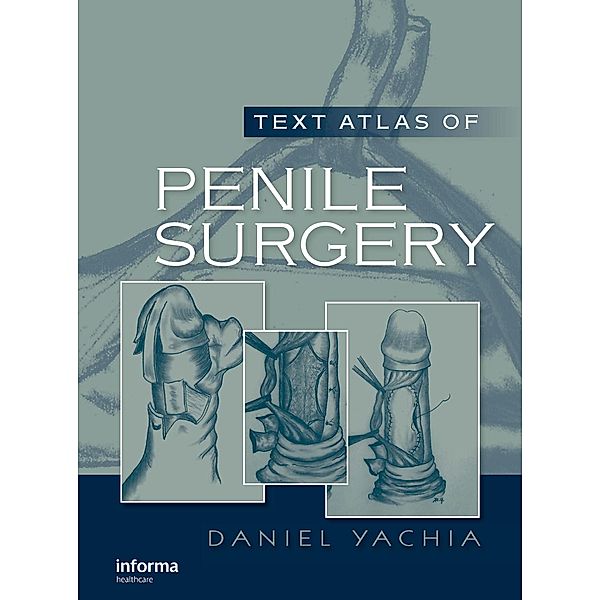 Text Atlas of Penile Surgery, Daniel Yachia