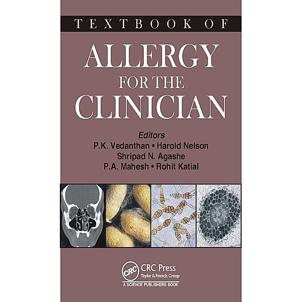 Textbook of Allergy for the Clinician