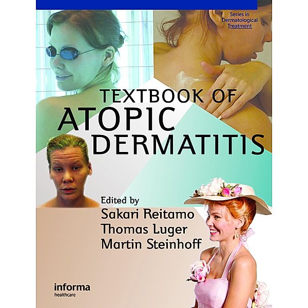 Textbook of Atopic Dermatitis, Sakari Reitamo, Thomas A. Luger, Martin Steinhoff