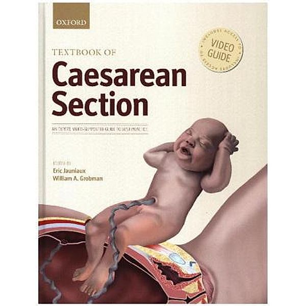 Textbook of Caesarean Section