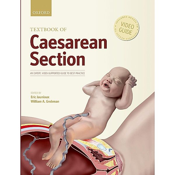 Textbook of Caesarean Section