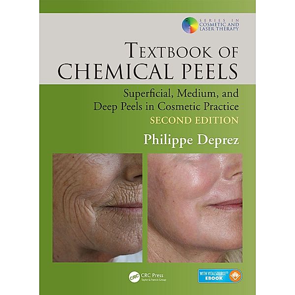 Textbook of Chemical Peels, Philippe Deprez