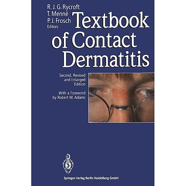 Textbook of Contact Dermatitis