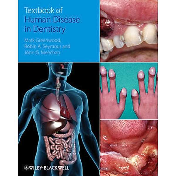 Textbook of Human Disease in Dentistry, Mark Greenwood, Robin Seymour, John Meechan