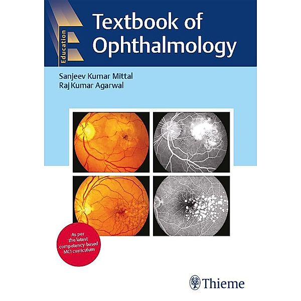 Textbook of Ophthalmology, Sanjeev Kumar Mittal, Raj Kumar Agarwal