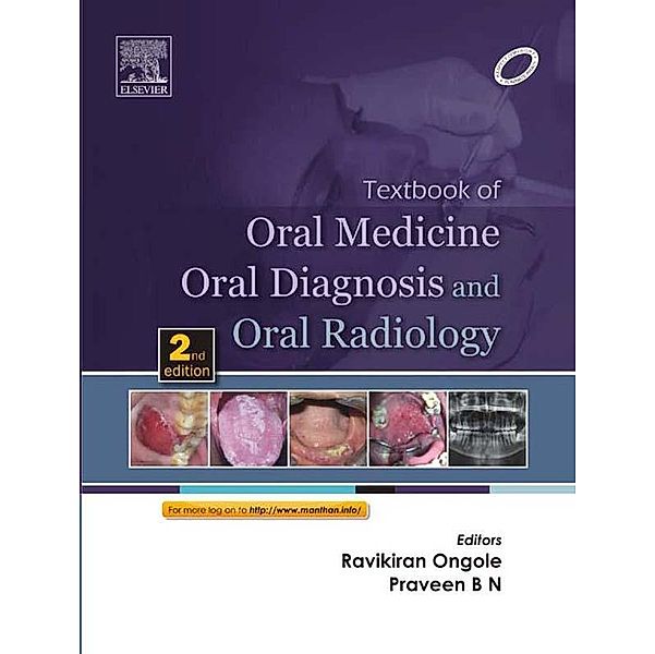 Textbook of Oral Medicine, Oral Diagnosis and Oral Radiology - E-Book