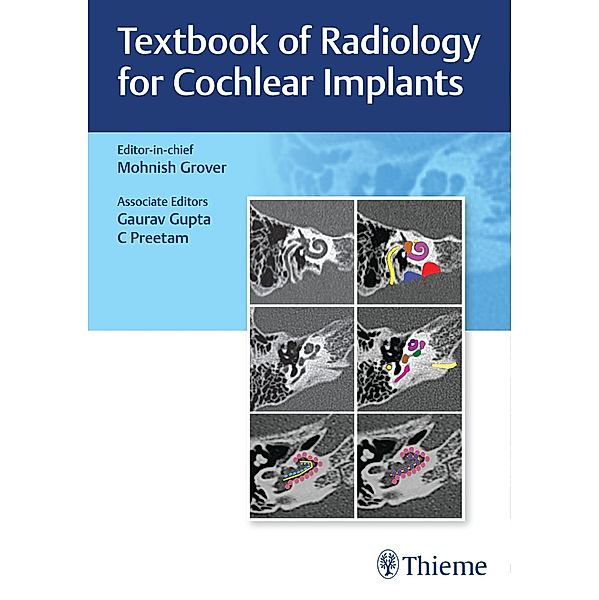 Textbook of Radiology for Cochlear Implants