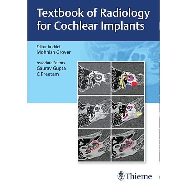 Textbook of Radiology for Cochlear Implants
