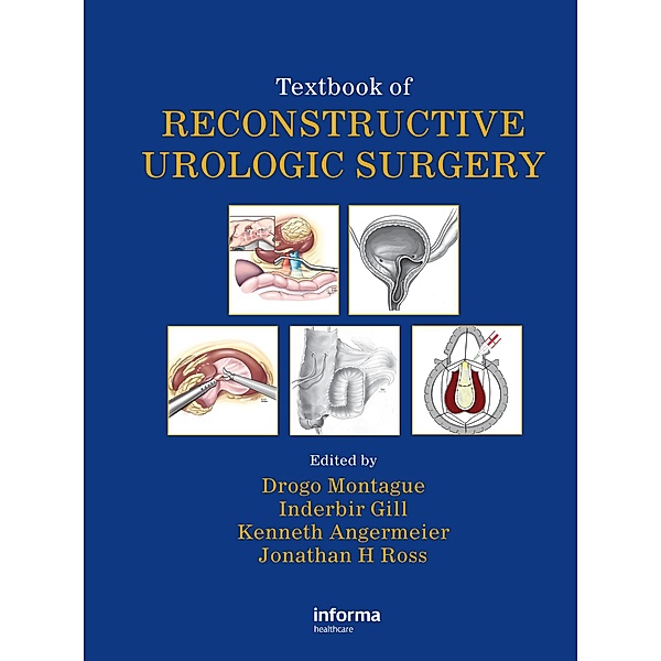 Textbook of Reconstructive Urologic Surgery