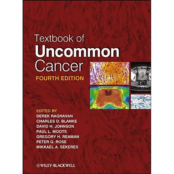 Textbook of Uncommon Cancer, Derek Raghavan, Charles Blanke, David H. Johnson, Paul L. Moots, Gregory H. Reaman, Peter G. Rose, Mik Sekeres