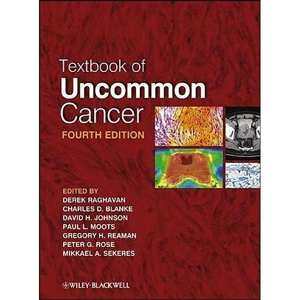 Textbook of Uncommon Cancer, Derek Raghavan, Charles Blanke, David H. Johnson, Paul L. Moots, Gregory H. Reaman, Peter G. Rose, Mikkael A. Sekeres