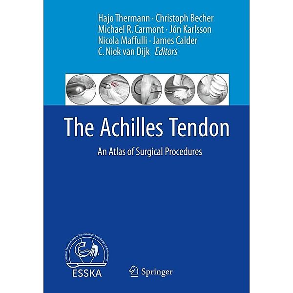 The Achilles Tendon