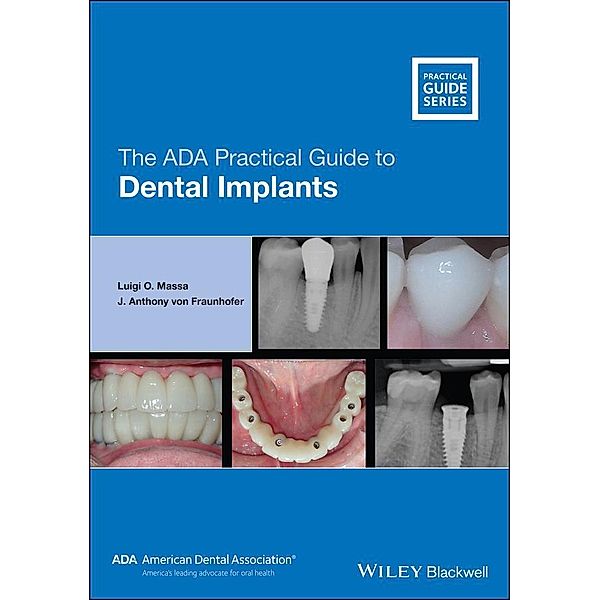 The ADA Practical Guide to Dental Implants / ADA Practical Guide, Luigi O. Massa, J. Anthony von Fraunhofer