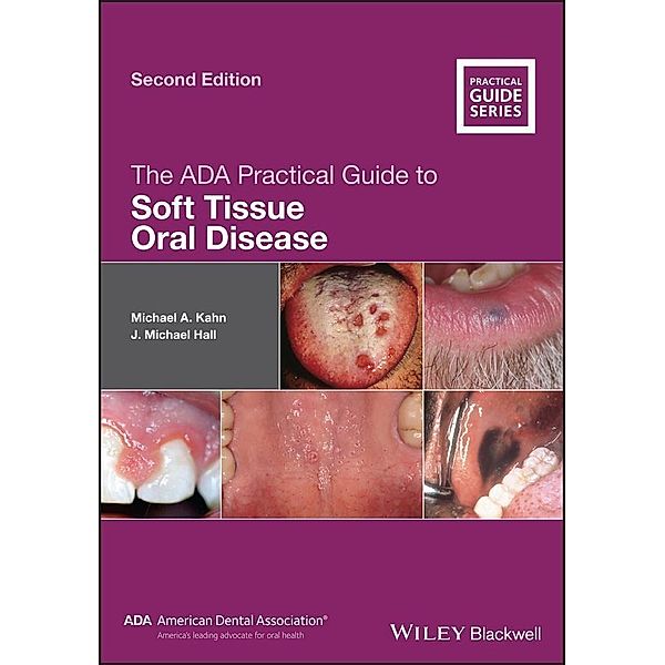 The ADA Practical Guide to Soft Tissue Oral Disease / ADA Practical Guide, Michael A. Kahn, J. Michael Hall