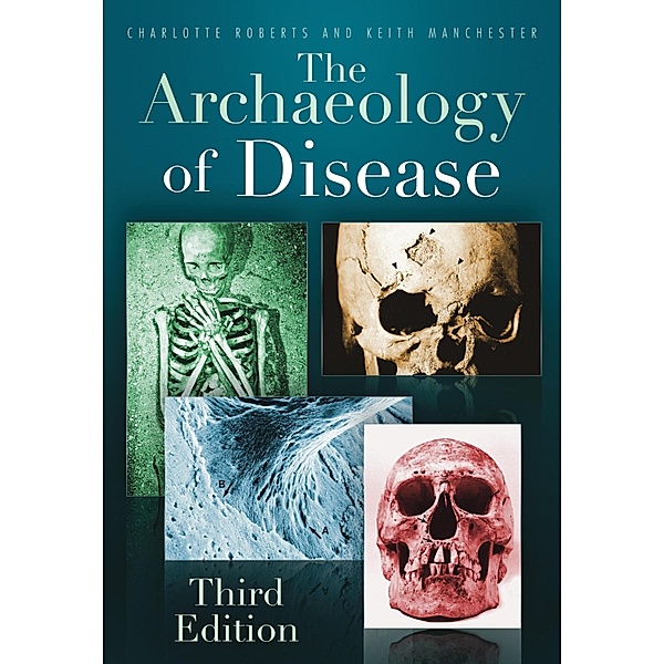 The Archaeology of Disease, Charlotte Roberts, Keith Manchester