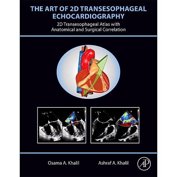 The Art of 2D Transesophageal Echocardiography, Osama A. Khalil, Ashraf A. Khalil