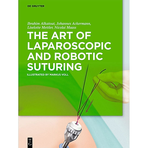 The Art of Laparoscopic and Robotic Suturing, Ibrahim Alkatout, Johannes Ackermann