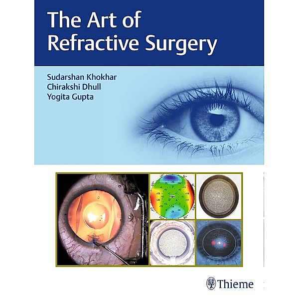 The Art of Refractive Surgery