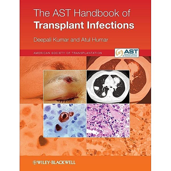The AST Handbook of Transplant Infections, Deepali Kumar, Atul Humar