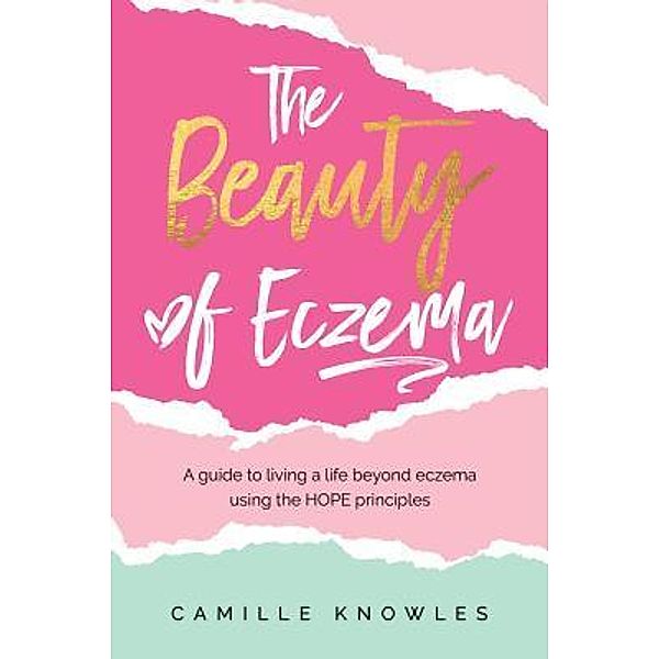 The Beauty of Eczema, Camille Knowles