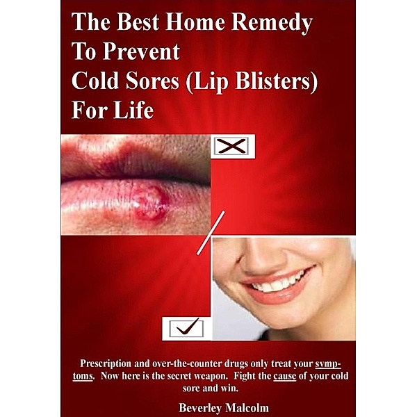 The Best Home Remedy To Prevent Cold Sores (Lip Blisters) For Life, Beverley Malcolm
