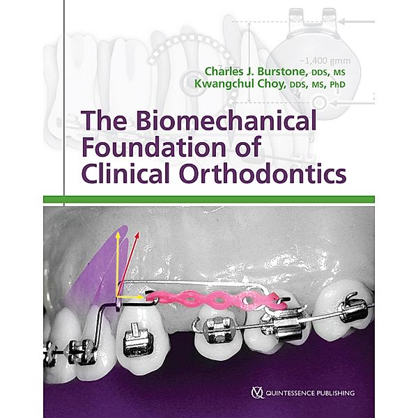 The Biomechanical Foundation of Clinical Orthodontics, Charles J. Burstone, Kwangchul Choy