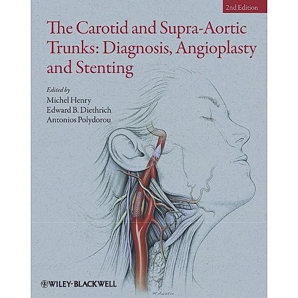The Carotid and Supra-Aortic Trunks, Michel Henry, Edward B. Diethrich, Antonios Polydorou