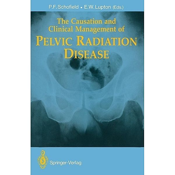 The Causation and Clinical Management of Pelvic Radiation Disease