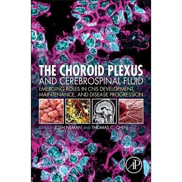 The Choroid Plexus and Cerebrospinal Fluid