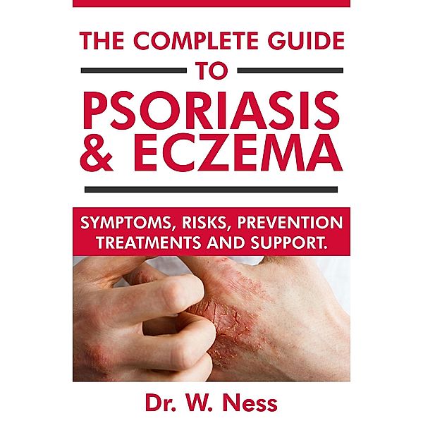 The Complete Guide to Psoriasis & Eczema: Symptoms, Risks, Prevention, Treatments & Support, W. Ness